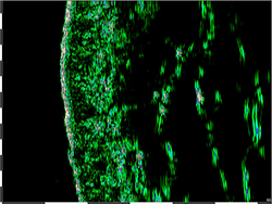 skin thickness after