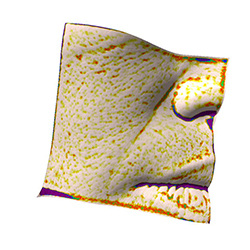 skin wrinkle  after(nasolabial fold)