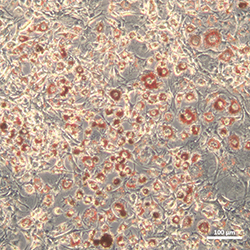 Adipogenesis-induced Group